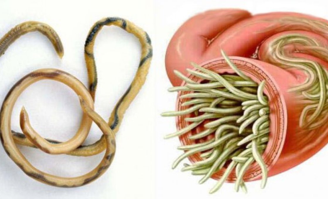 Новости про - Глисты, лямблии, амёбы и другие вредители в печени - признаки и как их вывести из организма