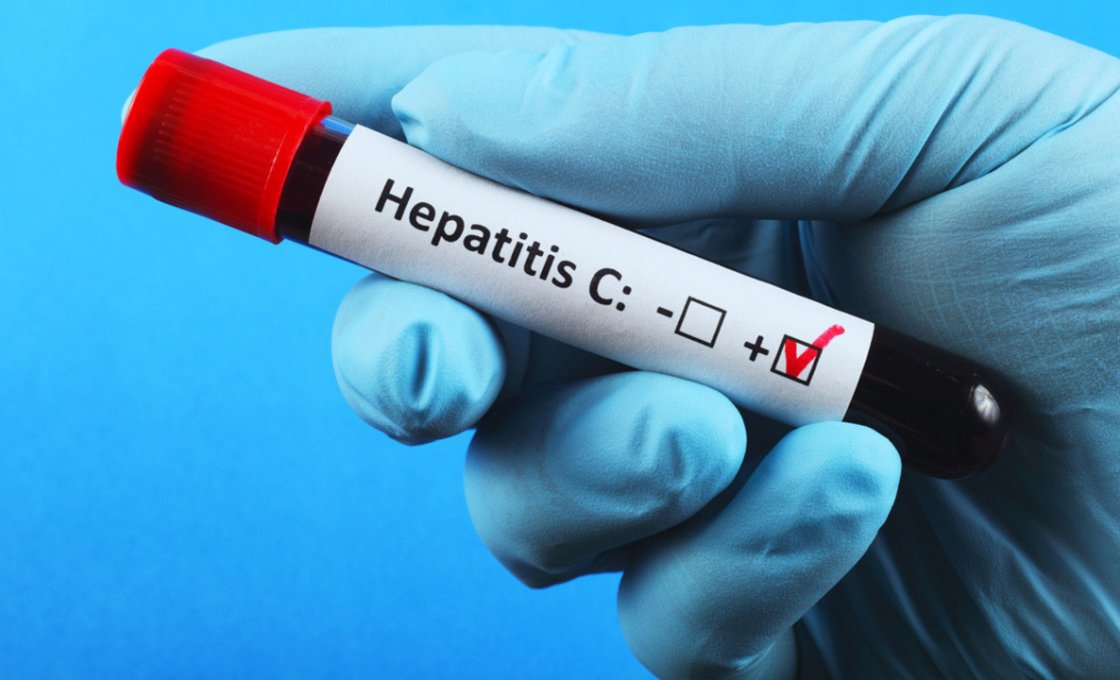 Новости про - Софосбувир (Sofosbuvir, Sofosbuvirum): описание, инструкция, особенности применения