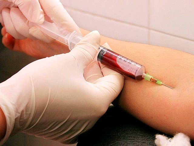 Новости про - Чем отличаются гепатит Б и С - разница между гепатитами, характеристика, пути инфицирования