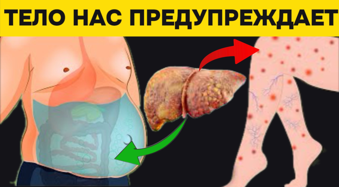 Новости про - Печеночная недостаточность