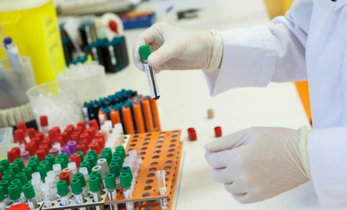 диагностика вич инфекции