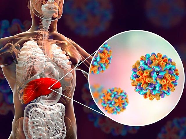 Новости про - 3 генотип гепатита С - особенности, проявления, способы лечения и прогноз