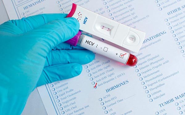 Новости про - Гепатит С генотипа 2 - что это такое, как лечить, как передается и сколько с ним живут